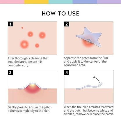 30 Pcs Pimple Patches